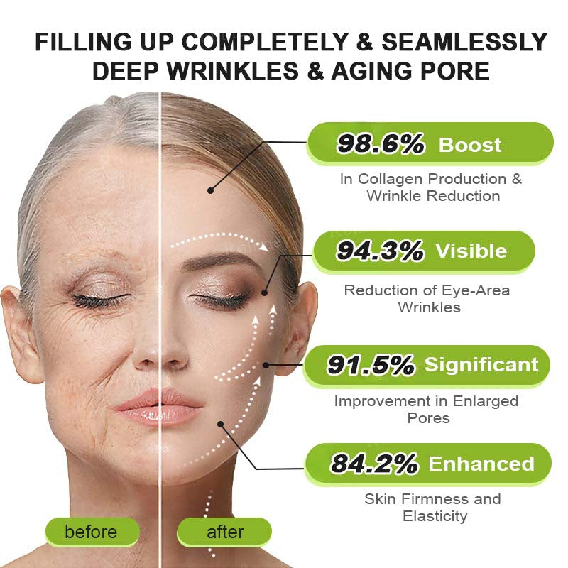Helps Improve the Look of Fine Lines & Texture — Gentle Retinol Night Cream