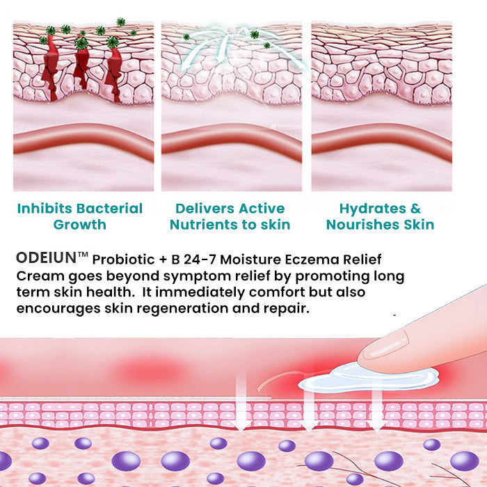 ODEIUN™ Probiotic + B 24-7 Moisture Eczema Relief Cream