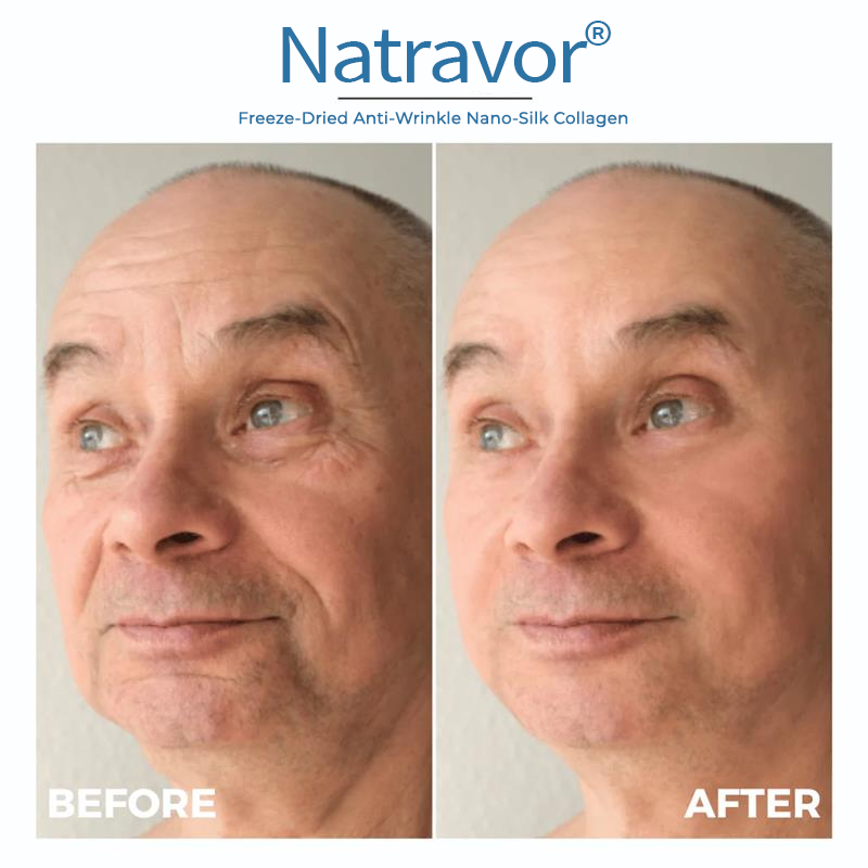 Natravor® Freeze-Dried Anti-Wrinkle Nano-Silk Collagen(Limited time discount offer)