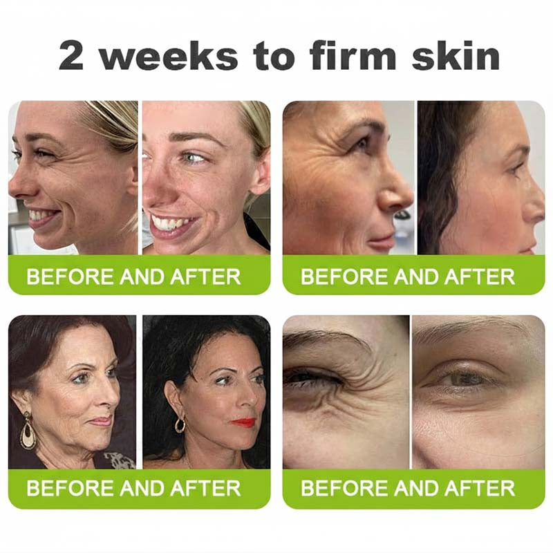 Helps Improve the Look of Fine Lines & Texture — Gentle Retinol Night Cream