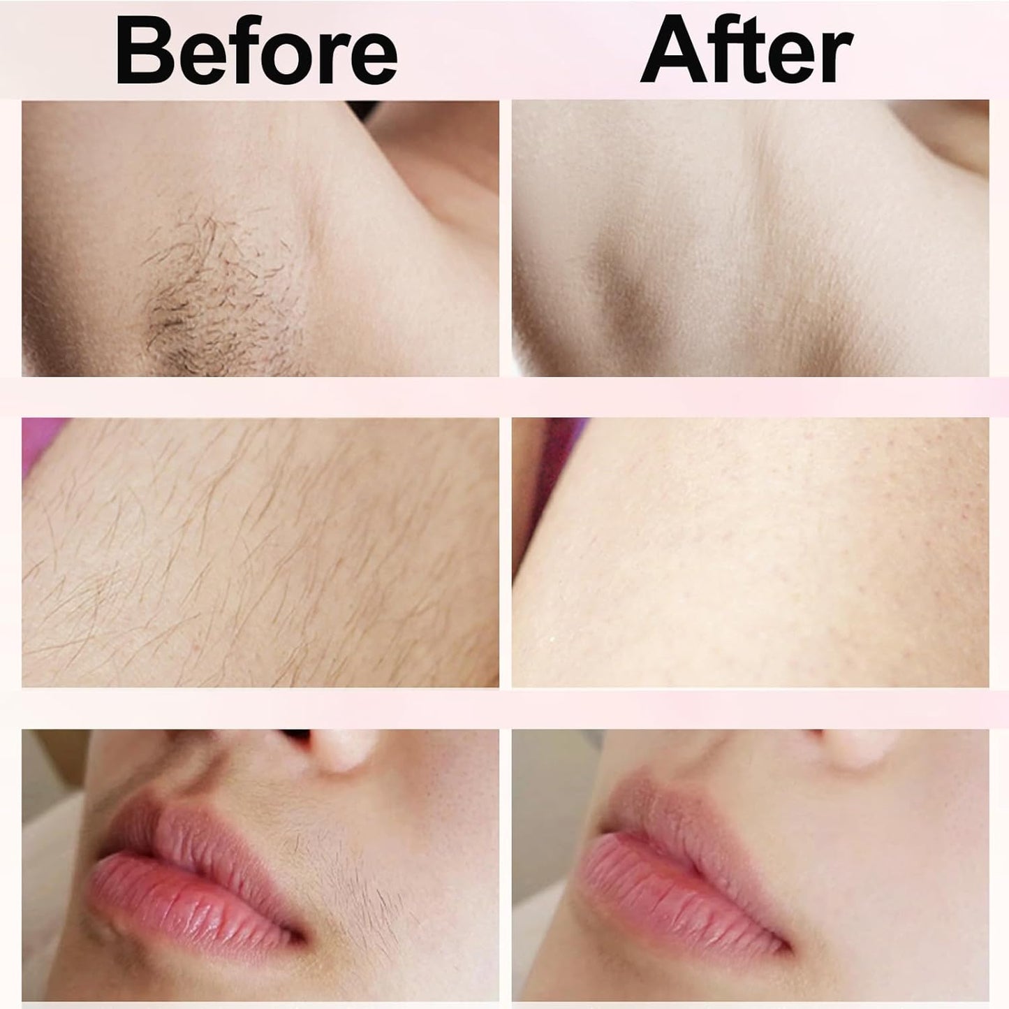 🔥Limited Time 49% Off🔥Bikini Trimmer for Women, Electric Shaver and Razor Rechargeable 2-in-1 Body and Facial Epilator