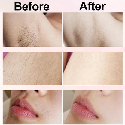 🔥Limited Time 49% Off🔥Bikini Trimmer for Women, Electric Shaver and Razor Rechargeable 2-in-1 Body and Facial Epilator