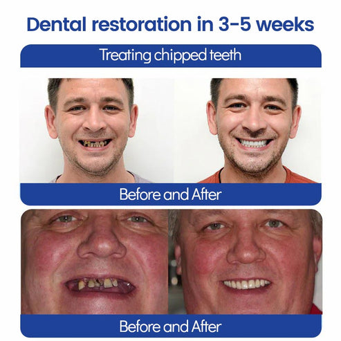 Natravor™ Whitening Tooth Cleansing Powder 🦷Obtain American Dental Association (ADA) Certification (Treats periodontitis and mouth ulcers, prevents tooth loss, and repairs gum recession)