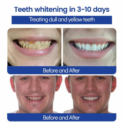 Natravor™ Whitening Tooth Cleansing Powder 🦷Obtain American Dental Association (ADA) Certification (Treats periodontitis and mouth ulcers, prevents tooth loss, and repairs gum recession)