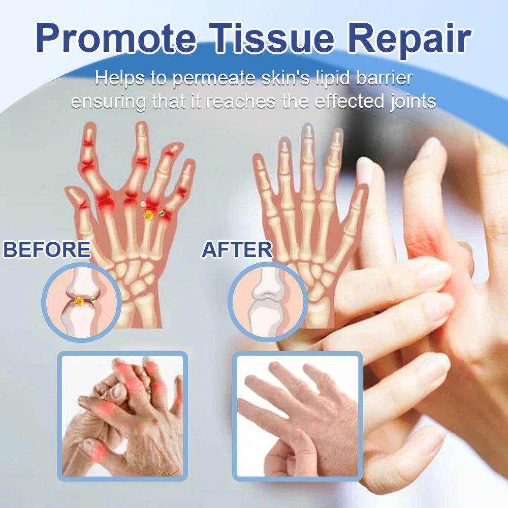 ✅𝐌𝐚𝐲𝐨 𝐂𝐥𝐢𝐧𝐢𝐜 𝐎𝐟𝐟𝐢𝐜𝐢𝐚𝐥: Natravor® Magnesium pain relief healing cream  (Treatment for arthritis, neuropathyy, rheumatic diseases, muscle spasms, twitches and sports injuries )