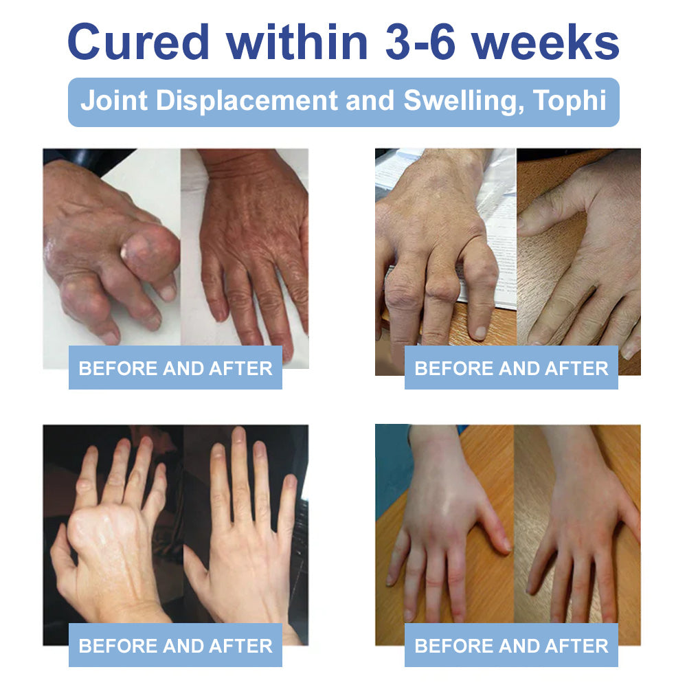 ✅𝐌𝐚𝐲𝐨 𝐂𝐥𝐢𝐧𝐢𝐜 𝐎𝐟𝐟𝐢𝐜𝐢𝐚𝐥: Natravor® Magnesium pain relief healing cream  (Treatment for arthritis, neuropathyy, rheumatic diseases, muscle spasms, twitches and sports injuries )