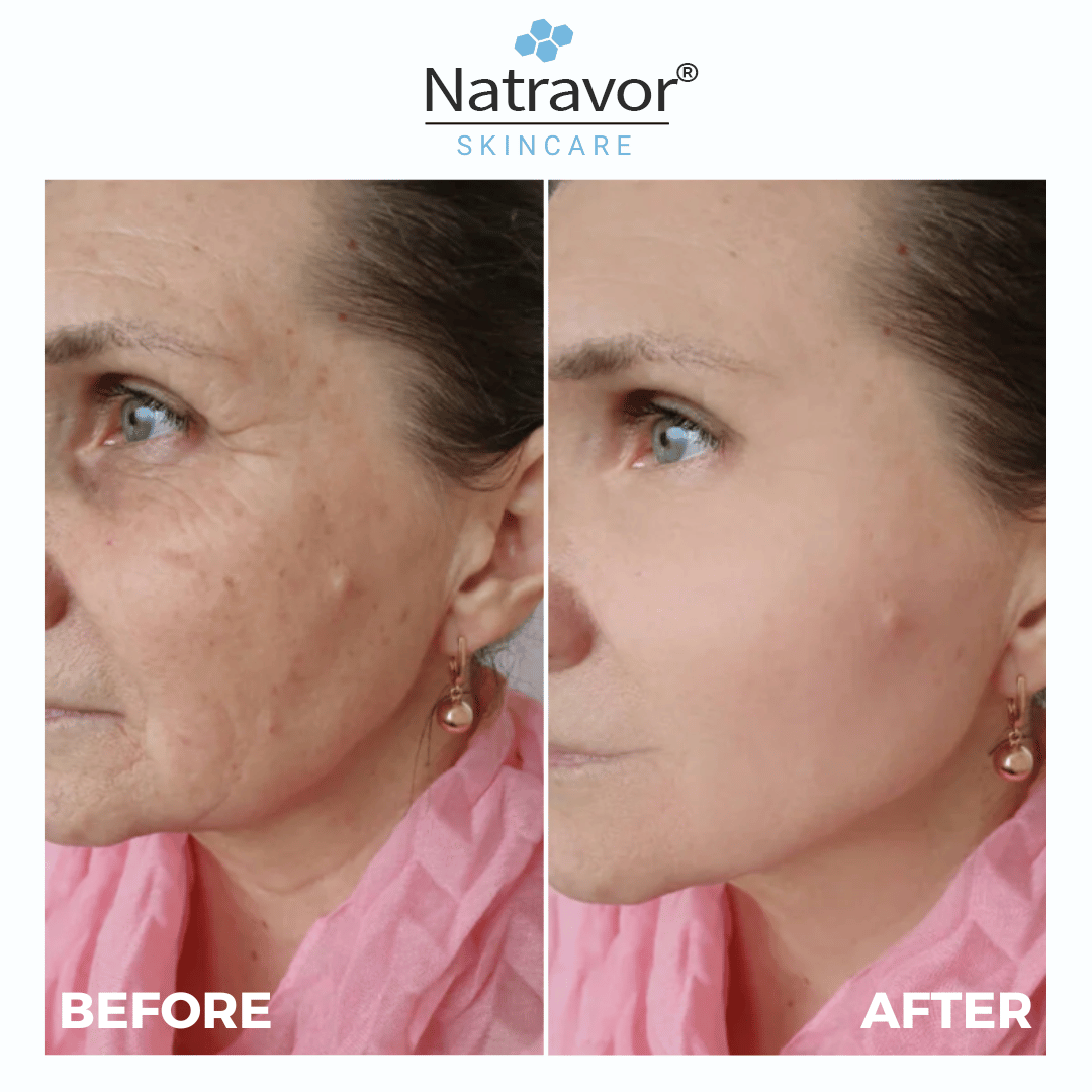 Natravor® Freeze-Dried Anti-Wrinkle Nano-Silk Collagen(Limited time discount offer)