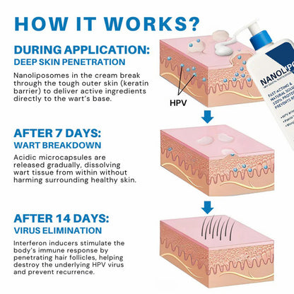 NanoLipo HPV Genital Warts Eraser Cream