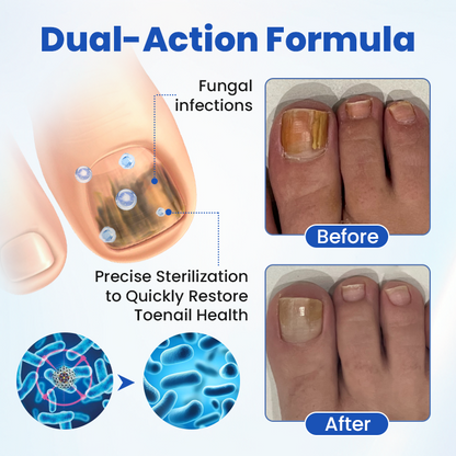 FungalPatch - Antibacterial Fungal Patch