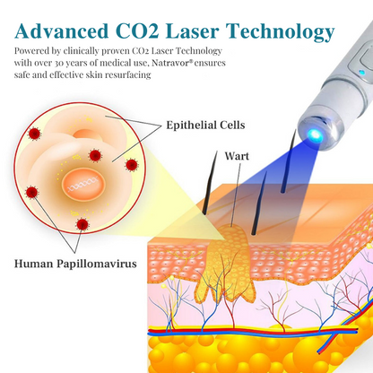 Natravor® LumeSkin Mole and Wart Removal Laser Pen