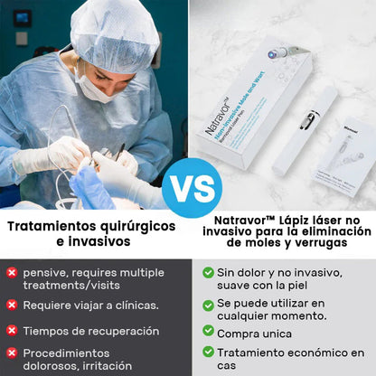 Lápiz láser no invasivo para la eliminación de lunares y verrugas Ｎatravor™